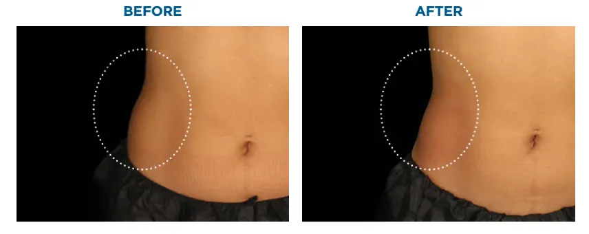 業務用TMキューブ　超音波/EMS/LED/光 BF-151 | 伊藤超短波 | 美顔機 | リフトアップ/EMS | 日本美容機